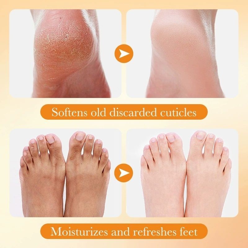 5x Pair Pack Goat Milk Essence Exfoliating Foot Mask Removes Dead Skin
